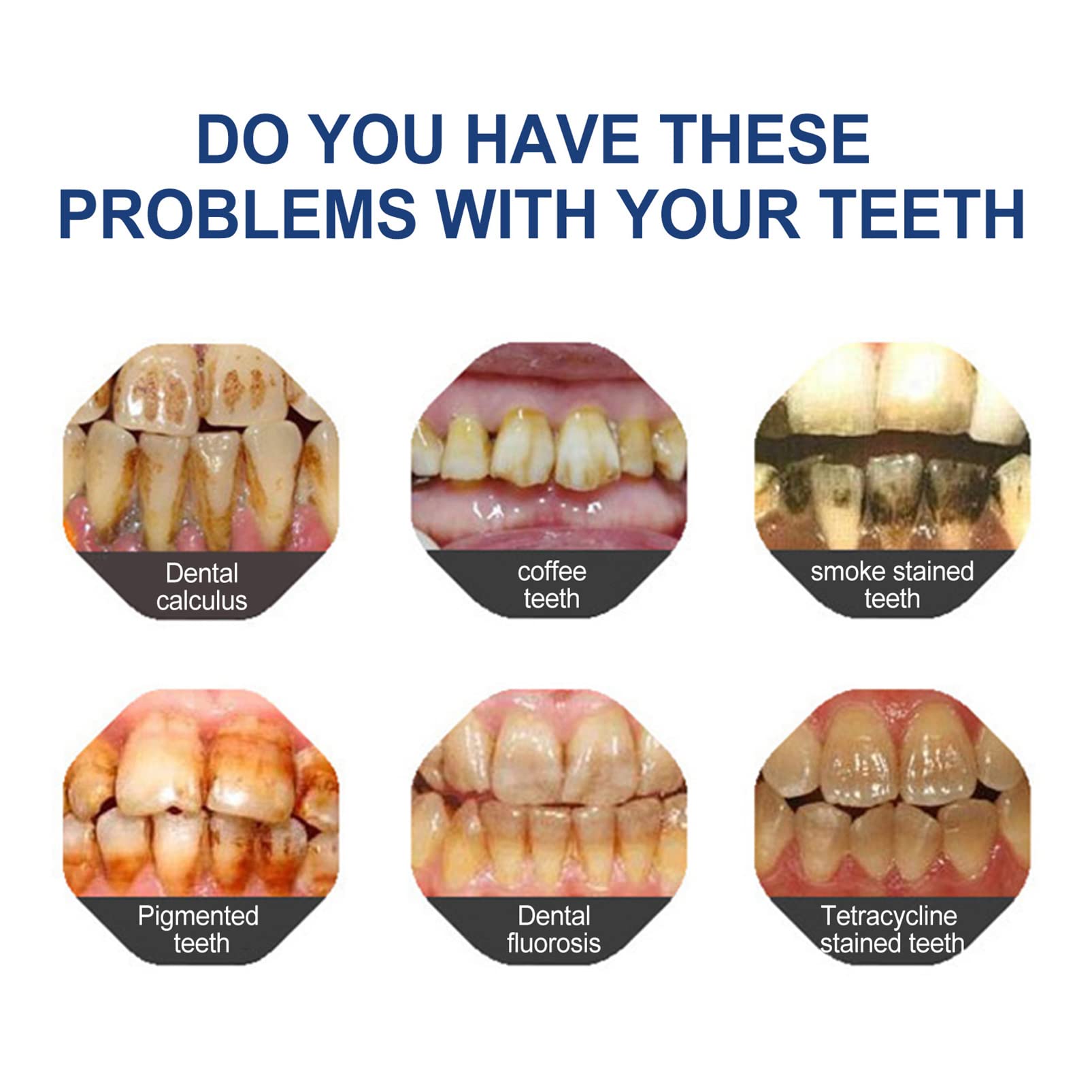 BBOJI™ Hydroxyapatite Toothpaste - Rebuild Enamel, End Sensitivity + 50% OFF