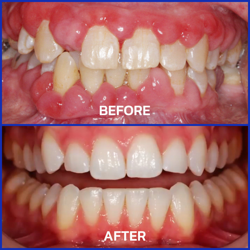 ODEIUN™ Bee Venom Dental Treatment Toothpaste