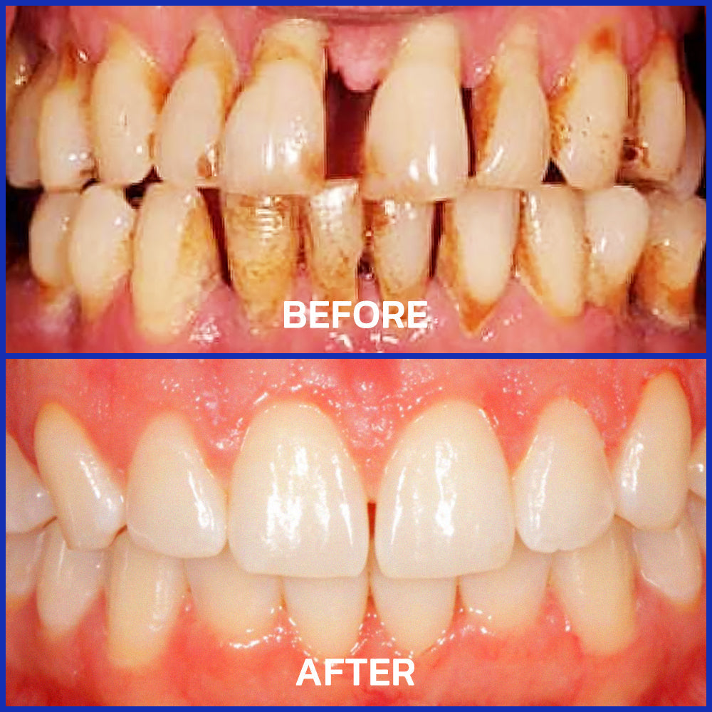 ODEIUN™ Bee Venom Dental Treatment Toothpaste